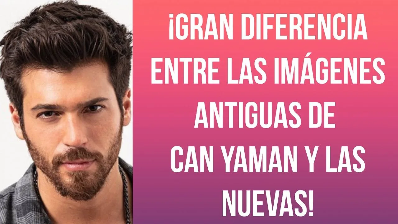 ¡Gran diferencia entre las imágenes antiguas de Can Yaman y las nuevas!