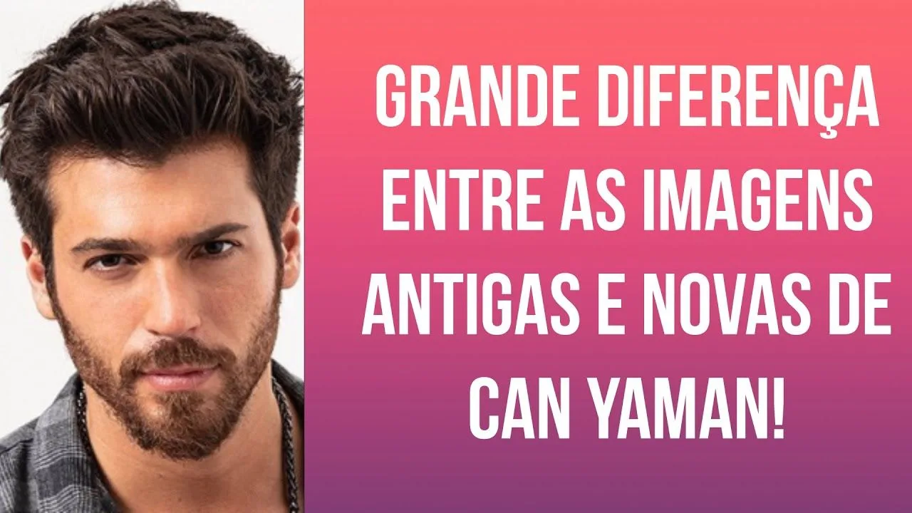 Grande diferença entre as imagens antigas e novas de Can Yaman!